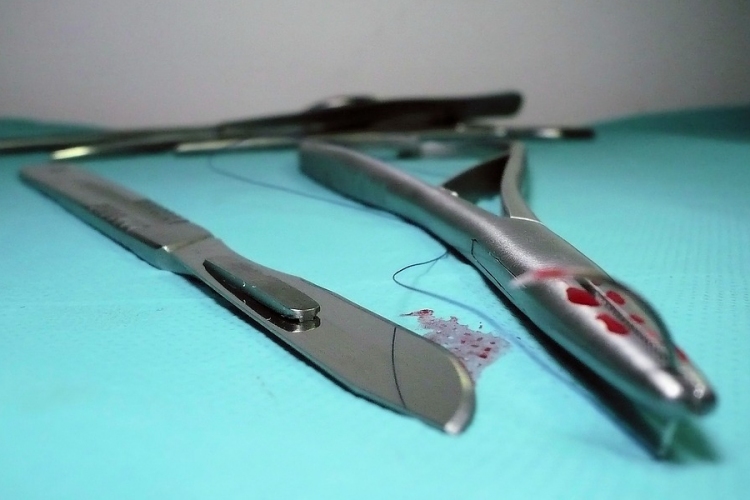 Illegális beavatkozások miatt indult eljárás egy plasztikai sebész ellen