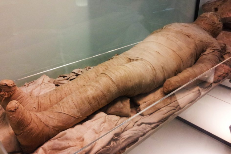 Múmiákban is kimutatták - a 7 leggyakoribb civilizációs betegség