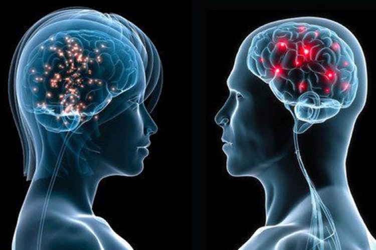 Újabb bizonyítékot találtak arra, hogy nem különbözik a férfi és a női agy